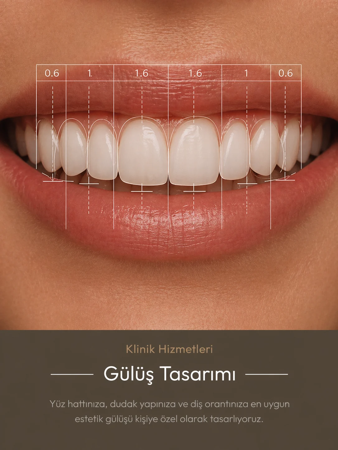 Hizmet gönderisi · Gülüş tasarımı